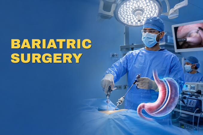 Bariatric Surgery